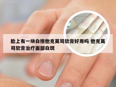 脸上有一块白擦他克莫司软膏好用吗 他克莫司软膏治疗面部白斑