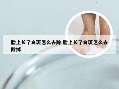 脸上长了白斑怎么去除 脸上长了白斑怎么去除掉