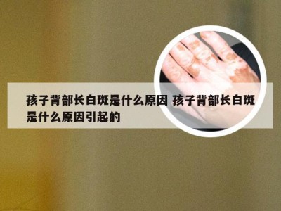 孩子背部长白斑是什么原因 孩子背部长白斑是什么原因引起的