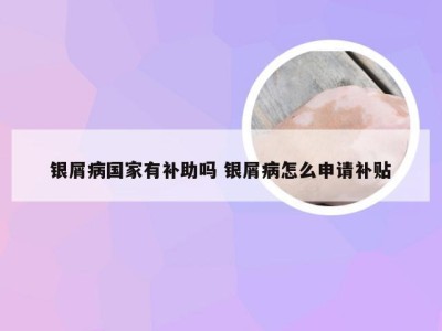 银屑病国家有补助吗 银屑病怎么申请补贴