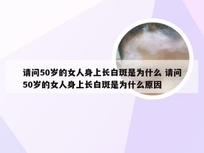 请问50岁的女人身上长白斑是为什么 请问50岁的女人身上长白斑是为什么原因