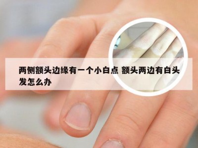 两侧额头边缘有一个小白点 额头两边有白头发怎么办