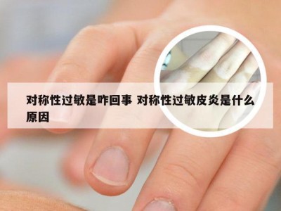 对称性过敏是咋回事 对称性过敏皮炎是什么原因