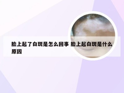 脸上起了白斑是怎么回事 脸上起白斑是什么原因