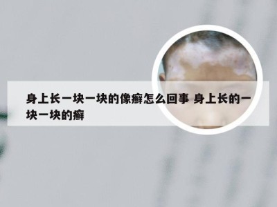 身上长一块一块的像癣怎么回事 身上长的一块一块的癣