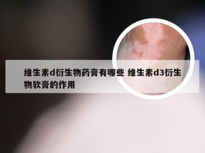 维生素d衍生物药膏有哪些 维生素d3衍生物软膏的作用