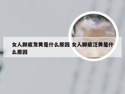 女人脚底发黄是什么原因 女人脚底泛黄是什么原因