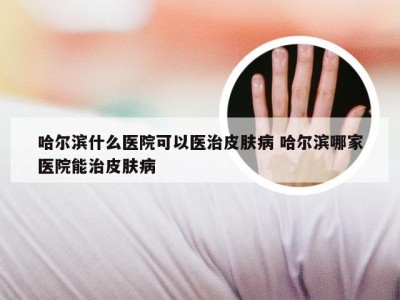 哈尔滨什么医院可以医治皮肤病 哈尔滨哪家医院能治皮肤病