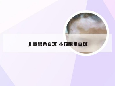 儿童眼角白斑 小孩眼角白斑