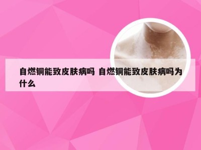 自燃铜能致皮肤病吗 自燃铜能致皮肤病吗为什么