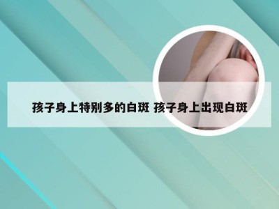 孩子身上特别多的白斑 孩子身上出现白斑