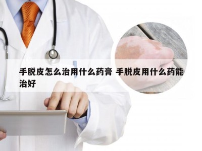 手脱皮怎么治用什么药膏 手脱皮用什么药能治好