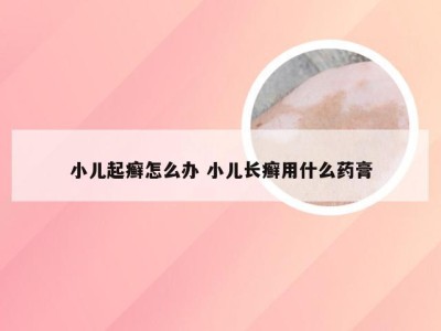 小儿起癣怎么办 小儿长癣用什么药膏