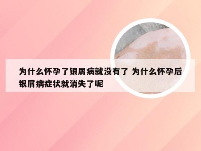 为什么怀孕了银屑病就没有了 为什么怀孕后银屑病症状就消失了呢