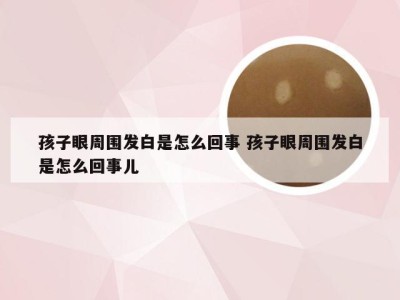 孩子眼周围发白是怎么回事 孩子眼周围发白是怎么回事儿