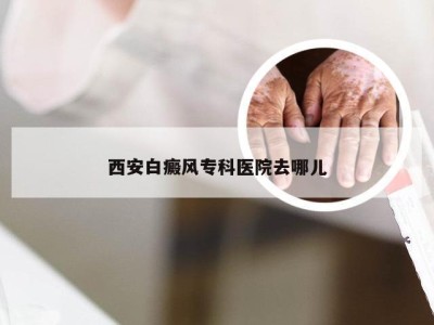 西安白癜风专科医院去哪儿