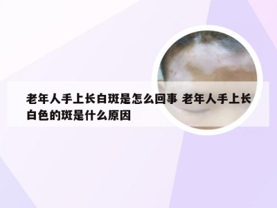 老年人手上长白斑是怎么回事 老年人手上长白色的斑是什么原因