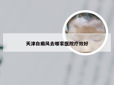 天津白癜风去哪家医院疗效好