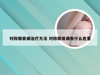 对称银屑病治疗方法 对称银屑病有什么危害