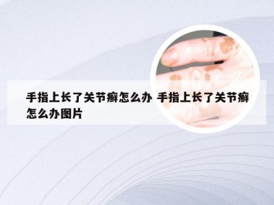 手指上长了关节癣怎么办 手指上长了关节癣怎么办图片