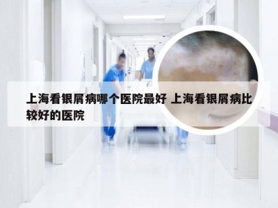 上海看银屑病哪个医院最好 上海看银屑病比较好的医院