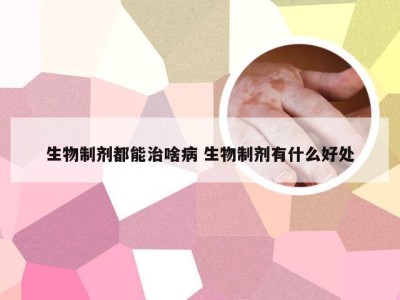 生物制剂都能治啥病 生物制剂有什么好处