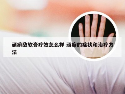 顽癣敌软膏疗效怎么样 顽癣的症状和治疗方法