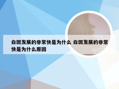 白斑发展的非常快是为什么 白斑发展的非常快是为什么原因