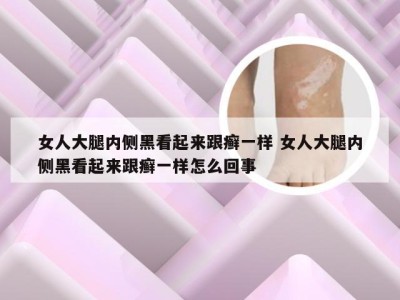 女人大腿内侧黑看起来跟癣一样 女人大腿内侧黑看起来跟癣一样怎么回事