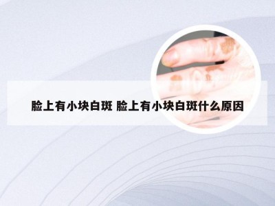 脸上有小块白斑 脸上有小块白斑什么原因