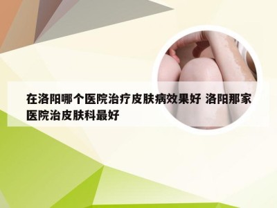 在洛阳哪个医院治疗皮肤病效果好 洛阳那家医院治皮肤科最好