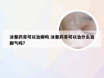 冰蚕药膏可以治癣吗 冰蚕药膏可以治什么治脚气吗?