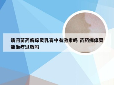 请问苗药癣痒灵乳膏中有激素吗 苗药癣痒灵能治疗过敏吗