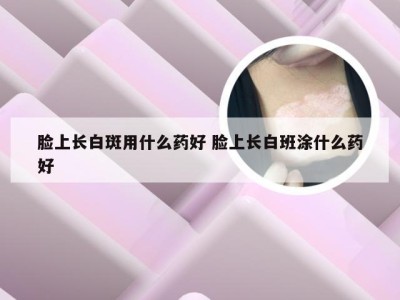 脸上长白斑用什么药好 脸上长白班涂什么药好