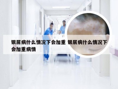 银屑病什么情况下会加重 银屑病什么情况下会加重病情