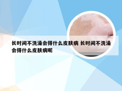 长时间不洗澡会得什么皮肤病 长时间不洗澡会得什么皮肤病呢