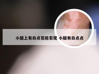 小腿上有白点若隐若现 小腿有白点点