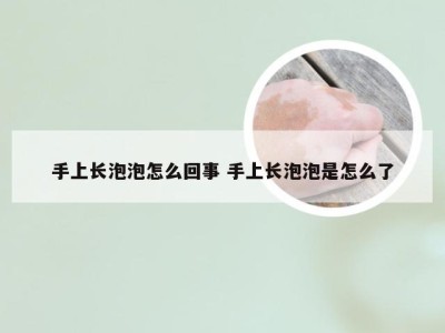 手上长泡泡怎么回事 手上长泡泡是怎么了