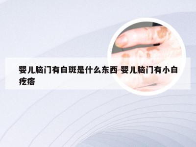 婴儿脑门有白斑是什么东西 婴儿脑门有小白疙瘩