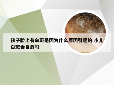 孩子脸上有白斑是因为什么原因引起的 小儿白斑会自愈吗