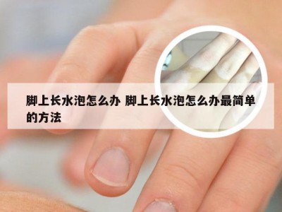 脚上长水泡怎么办 脚上长水泡怎么办最简单的方法