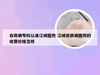 白斑病专科认准江城医院 江城皮肤病医院的收费价格怎样