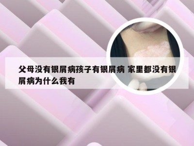 父母没有银屑病孩子有银屑病 家里都没有银屑病为什么我有