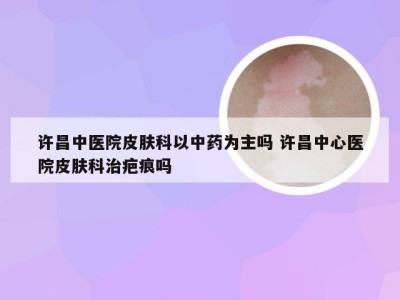 许昌中医院皮肤科以中药为主吗 许昌中心医院皮肤科治疤痕吗