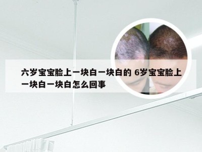 六岁宝宝脸上一块白一块白的 6岁宝宝脸上一块白一块白怎么回事