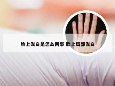 脸上发白是怎么回事 脸上局部发白