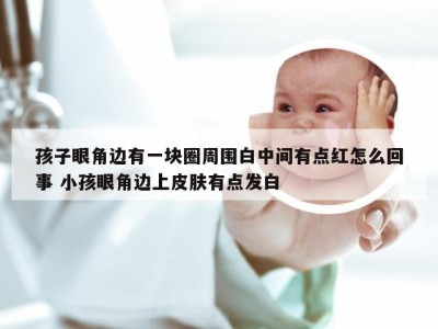 孩子眼角边有一块圈周围白中间有点红怎么回事 小孩眼角边上皮肤有点发白