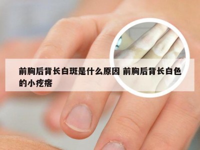 前胸后背长白斑是什么原因 前胸后背长白色的小疙瘩