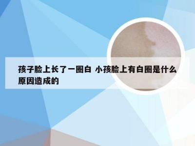 孩子脸上长了一圈白 小孩脸上有白圈是什么原因造成的