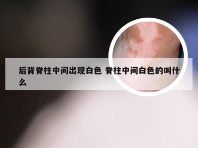 后背脊柱中间出现白色 脊柱中间白色的叫什么